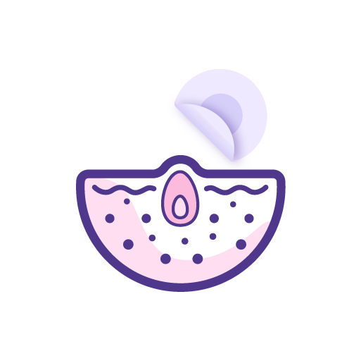 Acne-Prone Skin